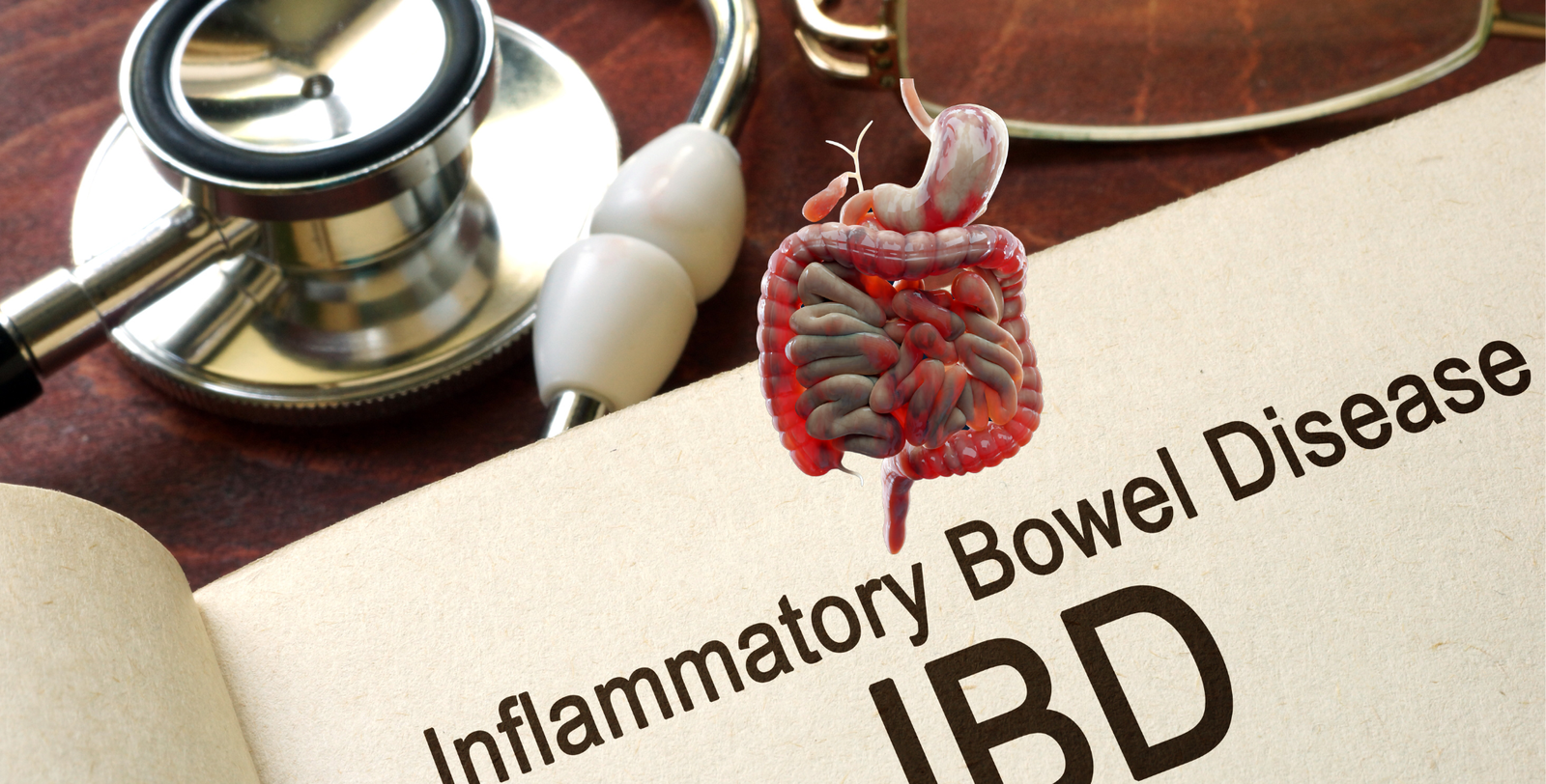 Inflammatory Bowel Disease Inflammatory Bowel Disease